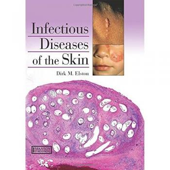 Infectious Diseases of the Skin