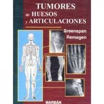 Tumores de huesos y articulaciones