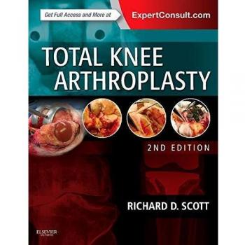 Total Knee Arthroplasty, 2e
