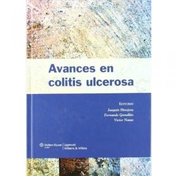 Avances en colitis ulcerosa