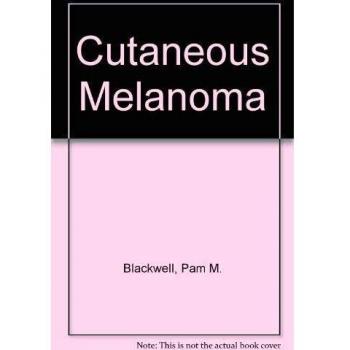 Cutaneous Melanoma