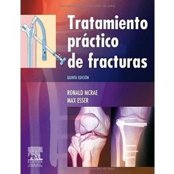 Tratamiento práctico de fracturas