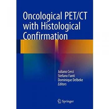 Oncological PET/CT with Histological Confirmation