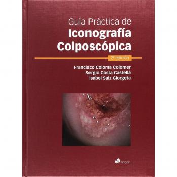 Guía Práctica de Iconografía Colposcópica