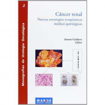 Cáncer renal. Nuevas estrategias terapeuticas medico-quirurgicas