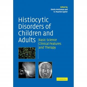 Trastornos Histiocíticos en Niños y Adultos: Ciencia Básica, Características Clínicas y Terapia