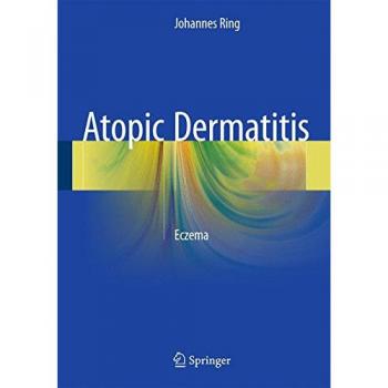 Atopic Dermatitis: Eczema