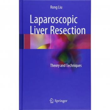 Laparoscopic Liver Resection: Theory and Techniques