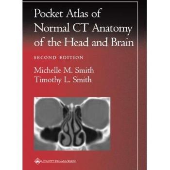 Pocket Atlas of Normal CT Anatomy of the Head and Brain