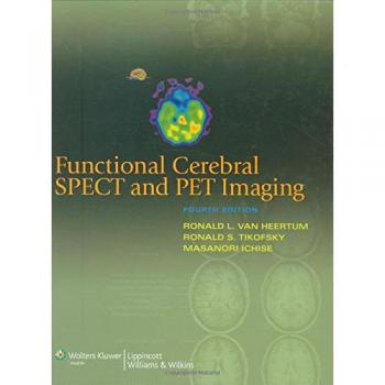 Functional Cerebral SPECT and PET Imaging
