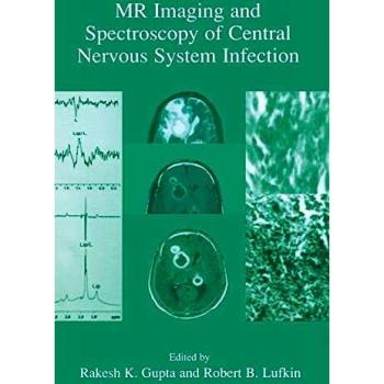 MR Imaging and Spectroscopy of Central Nervous System Infection