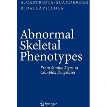Abnormal Skeletal Phenotypes: From Simple Signs to Complex Diagnoses