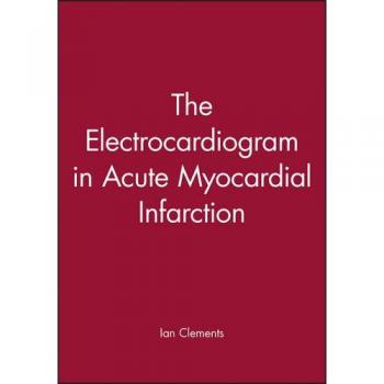The Electrocardiogram in Acute Myocardial Infarction