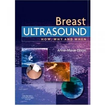Breast Ultrasound,: How, Why and When