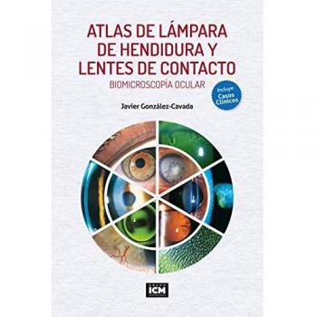 ATLAS DE LÁMPARA DE HENDIDURA Y LENTES DE CONTACTO