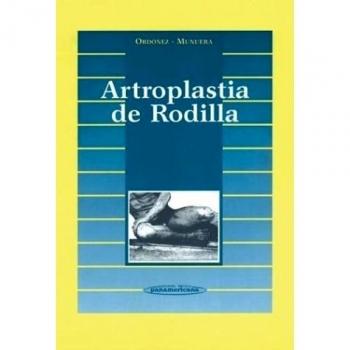 Artroplastia de Rodilla