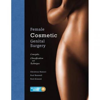 Female Cosmetic Genital Surgery: Concepts, classification and techniques