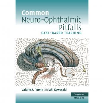Common Neuro-Ophthalmic Pitfalls: Case-Based Teaching (Paperback Edition)