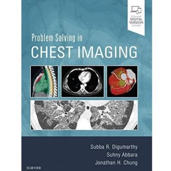 Problem Solving in Chest Imaging, 1e