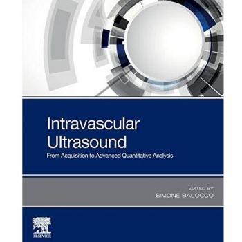 Intravascular Ultrasound: From Acquisition to Advanced Quantitative Analysis