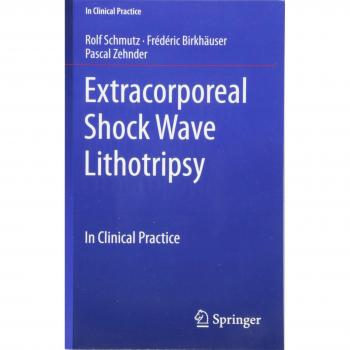 Extracorporeal Shock Wave Lithotripsy: In Clinical Practice