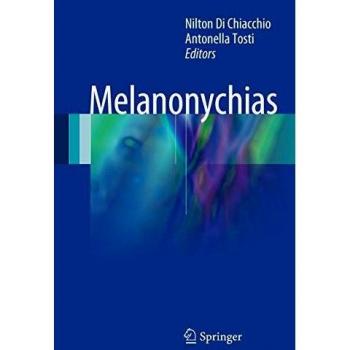 Melanonychias