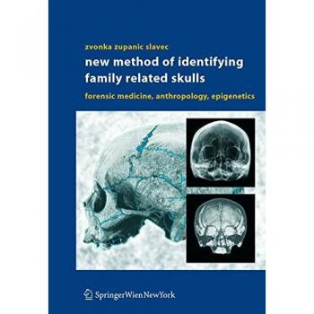 New Method of Identifying Family Related Skulls: Forensic Medicine, Anthropology, Epigenetics