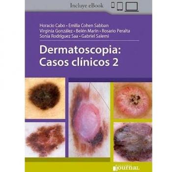 DERMATOSCOPIA CASOS CLINICOS 2