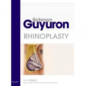 Rhinoplasty: Expert Consult Premium Edition - Enhanced Online Features and Print, 1e
