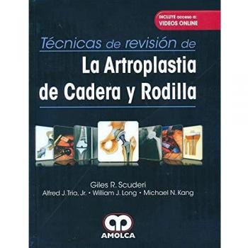 TECNICAS REVISION ARTROPLASTIA CADERA RODILLA VIDEOS ONLINE