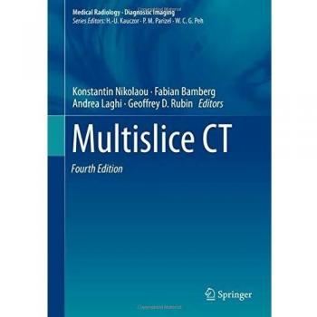 Multislice CT