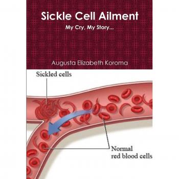 Células Sickle - Tratamiento Avanzado para Anemia Falciforme con Ingredientes Naturales