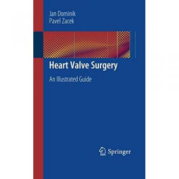 Heart Valve Surgery: An Illustrated Guide