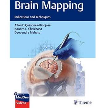 Brain Mapping: Indications and Techniques