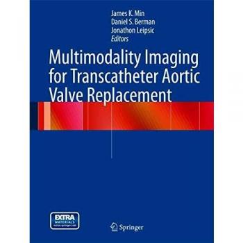 Multimodality Imaging for Transcatheter Aortic Valve Replacement