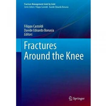 Fractures Around the Knee