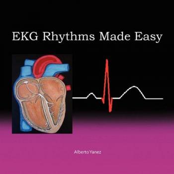 Easy EKG Rhythm Guide by Alberto Yanez