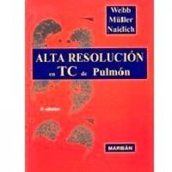 Alta resolución en TC de pulmón
