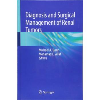 Diagnosis and Surgical Management of Renal Tumors