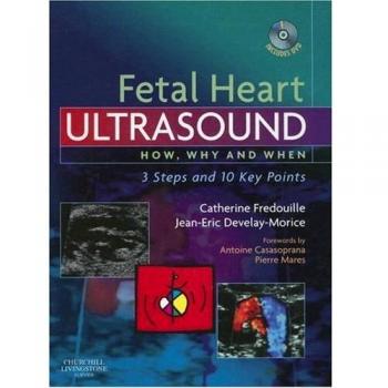 Fetal Heart Ultrasound: How, Why and When, 1e