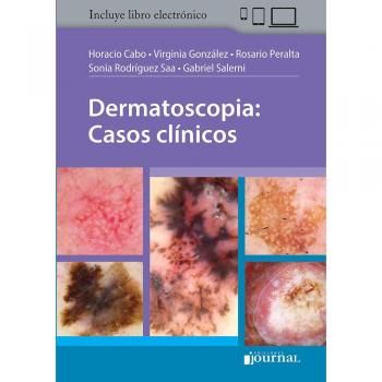 Dermatoscopia. Casos Clínicos + ebook