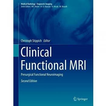 Clinical Functional MRI: Presurgical Functional Neuroimaging
