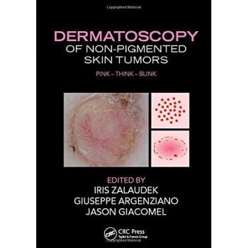 Dermatoscopy of Non-Pigmented Skin Tumors: Pink - Think - Blink