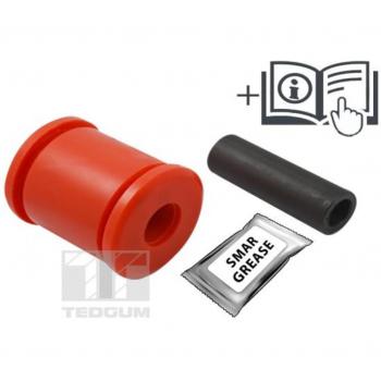 Cojinete de ballesta TEDGUM 00348104, características: fabricado en material duradero, diseño específico para una instalación precisa, alta resistencia al desgaste y a la presión, compatible con múltiples modelos de vehículos