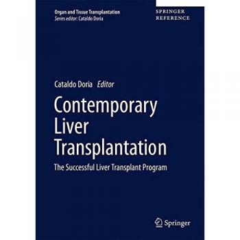 Contemporary Liver Transplantation: The Successful Liver Transplant Program
