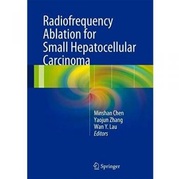Radiofrequency Ablation for Small Hepatocellular Carcinoma