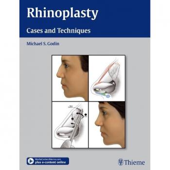 Rhinoplasty Mastery: Comprehensive Cases and Techniques Guide