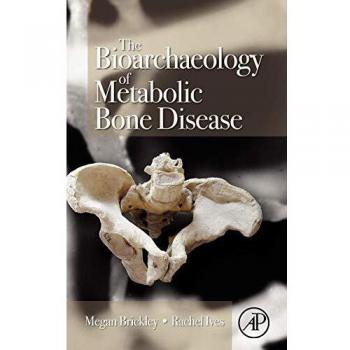 The Bioarchaeology of Metabolic Bone Disease