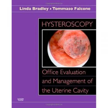 Hysteroscopy: Office Evaluation and Management of the Uterine Cavity: Text with DVD-ROM, 1e: Office Evaluation of the Uterine Cavity and Management