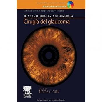 Cirugía del glaucoma + DVD-ROM